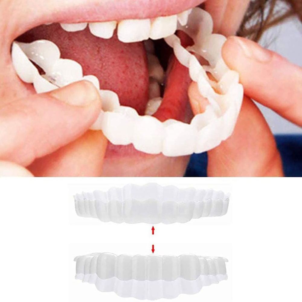 Snap On Smile 