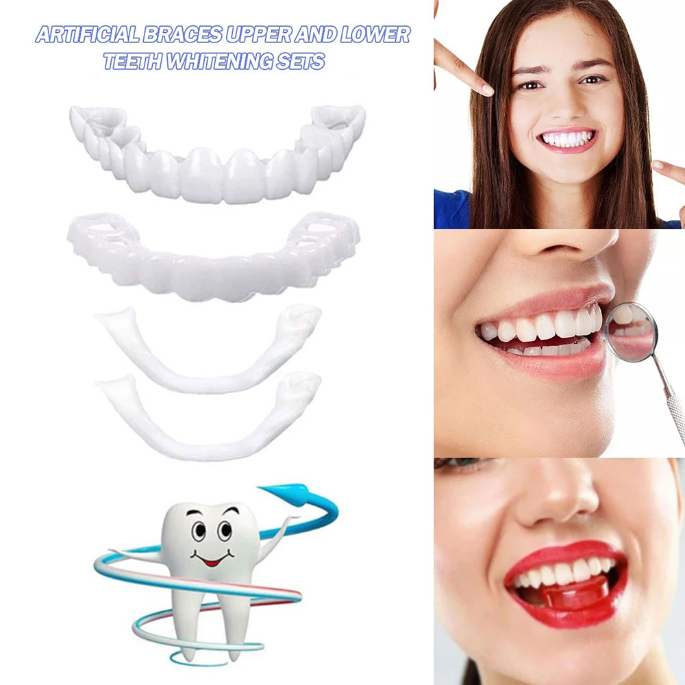 Snap On Smile 