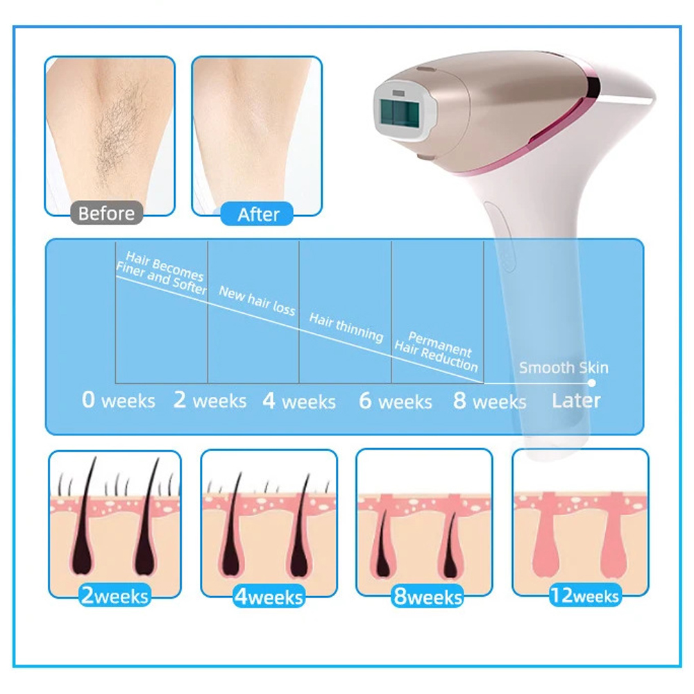 IPL Laser Hair Removal
